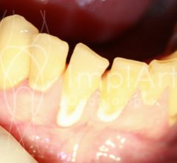 Periodontia