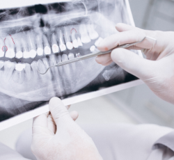 Radiografia Geral